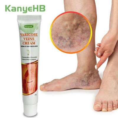 Pommade Kanyehb pour les varices